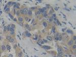 PFKP Antibody in Immunohistochemistry (Paraffin) (IHC (P))