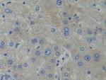 PFKP Antibody in Immunohistochemistry (Paraffin) (IHC (P))