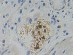 PFKP Antibody in Immunohistochemistry (Paraffin) (IHC (P))