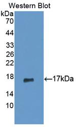 GCDFP-15 Antibody in Western Blot (WB)