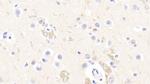 RTN1 Antibody in Immunohistochemistry (Paraffin) (IHC (P))