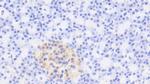 RTN1 Antibody in Immunohistochemistry (Paraffin) (IHC (P))