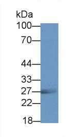 RTN1 Antibody in Western Blot (WB)