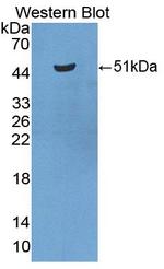 RTN1 Antibody in Western Blot (WB)