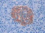 SLIT1 Antibody in Immunohistochemistry (Paraffin) (IHC (P))