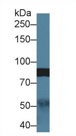 SLIT1 Antibody in Western Blot (WB)