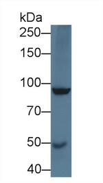 SLIT1 Antibody in Western Blot (WB)