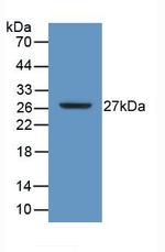 CD298 Antibody in Western Blot (WB)