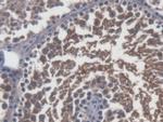 Sp17 Antibody in Immunohistochemistry (Paraffin) (IHC (P))