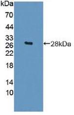 Sp17 Antibody in Western Blot (WB)