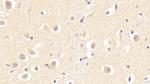 SKP1 Antibody in Immunohistochemistry (Paraffin) (IHC (P))