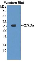 SDF2L1 Antibody in Western Blot (WB)