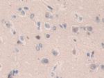 SMC3 Antibody in Immunohistochemistry (Paraffin) (IHC (P))