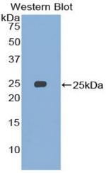 SMC3 Antibody in Western Blot (WB)