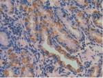 SERPINA7 Antibody in Immunohistochemistry (Paraffin) (IHC (P))