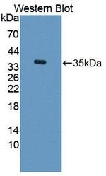 Transketolase Antibody in Western Blot (WB)