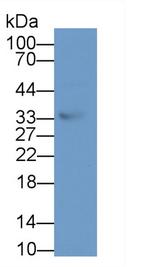 TSG Antibody in Western Blot (WB)