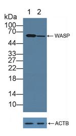 WASP Antibody in Western Blot (WB)