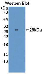 WASP Antibody in Western Blot (WB)