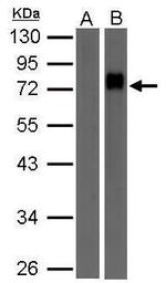 Biotin Antibody in Western Blot (WB)