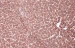 MEK1 Antibody in Immunohistochemistry (Paraffin) (IHC (P))