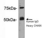 Complement C4b Antibody in Western Blot (WB)