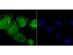 RARA Antibody in Immunocytochemistry (ICC/IF)