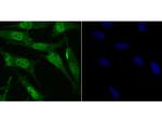 RARA Antibody in Immunocytochemistry (ICC/IF)