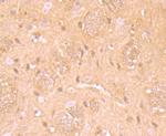 RARA Antibody in Immunohistochemistry (Paraffin) (IHC (P))