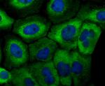 MFN2 Antibody in Immunocytochemistry (ICC/IF)