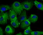 CRMP2 Antibody in Immunocytochemistry (ICC/IF)