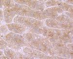 ApoC3 Antibody in Immunohistochemistry (Paraffin) (IHC (P))