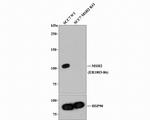 MSH2 Antibody in Western Blot (WB)