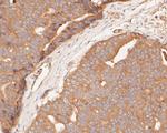 GSDMD Antibody in Immunohistochemistry (Paraffin) (IHC (P))