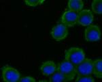 ADAM22 Antibody in Immunocytochemistry (ICC/IF)