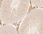 HDLBP Antibody in Immunohistochemistry (Paraffin) (IHC (P))