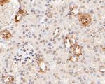 HDLBP Antibody in Immunohistochemistry (Paraffin) (IHC (P))