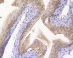 S100A2 Antibody in Immunohistochemistry (Paraffin) (IHC (P))