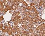 S100A2 Antibody in Immunohistochemistry (Paraffin) (IHC (P))