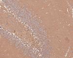 RALA Antibody in Immunohistochemistry (Paraffin) (IHC (P))