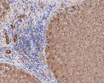 ERAB Antibody in Immunohistochemistry (Paraffin) (IHC (P))