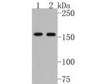 PLA2R1 Antibody in Western Blot (WB)