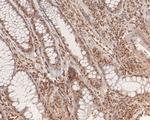 SNRPD3 Antibody in Immunohistochemistry (Paraffin) (IHC (P))