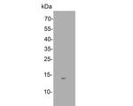 SNRPD3 Antibody in Western Blot (WB)