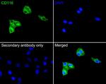 CD116 Antibody in Immunocytochemistry (ICC/IF)