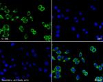 IL2RG Antibody in Immunocytochemistry (ICC/IF)