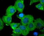 ALDH1A1 Antibody in Immunocytochemistry (ICC/IF)