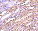 ALDH1A1 Antibody in Immunohistochemistry (Paraffin) (IHC (P))