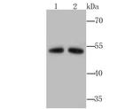 ALDH1A1 Antibody in Western Blot (WB)