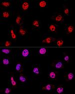 HDAC1 Antibody in Immunocytochemistry (ICC/IF)